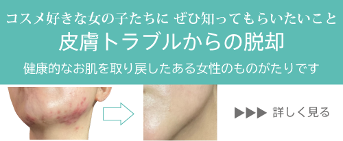 サンエイジ：皮膚トラブルからの脱却